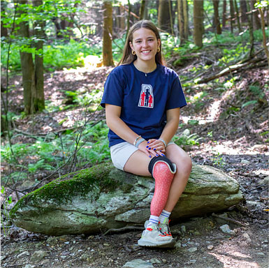 A young adult female leg amputee sits on a boulder in a forest.