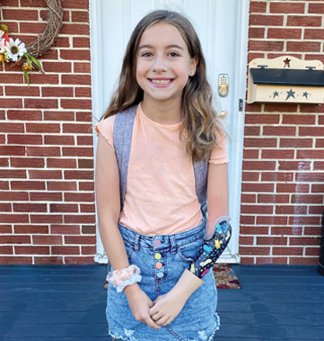A young female arm amputee stands in front of her house.
