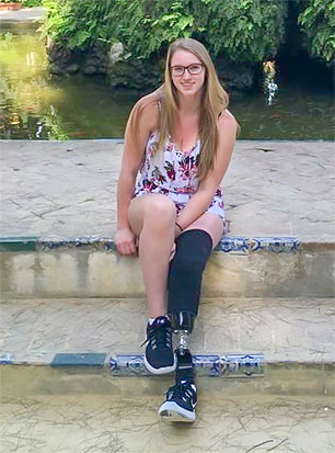Champ Julie, a leg amputee, sitting on steps beside a pond of water.