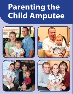 Parenting the Child Amputee